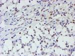 MLF1 Antibody in Immunohistochemistry (Paraffin) (IHC (P))
