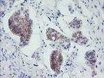 MLF1 Antibody in Immunohistochemistry (Paraffin) (IHC (P))