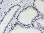 MLF1 Antibody in Immunohistochemistry (Paraffin) (IHC (P))