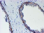 MLF1 Antibody in Immunohistochemistry (Paraffin) (IHC (P))