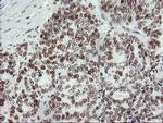 MLF1 Antibody in Immunohistochemistry (Paraffin) (IHC (P))
