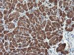 MLF1 Antibody in Immunohistochemistry (Paraffin) (IHC (P))