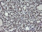 MLF1 Antibody in Immunohistochemistry (Paraffin) (IHC (P))