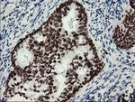 MLF1 Antibody in Immunohistochemistry (Paraffin) (IHC (P))