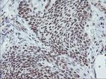 MLF1 Antibody in Immunohistochemistry (Paraffin) (IHC (P))