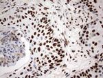 MLF1 Antibody in Immunohistochemistry (Paraffin) (IHC (P))