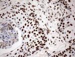MLF1 Antibody in Immunohistochemistry (Paraffin) (IHC (P))