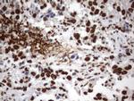 MLF1 Antibody in Immunohistochemistry (Paraffin) (IHC (P))