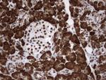 MLF1 Antibody in Immunohistochemistry (Paraffin) (IHC (P))