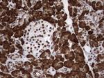 MLF1 Antibody in Immunohistochemistry (Paraffin) (IHC (P))