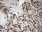 MLF1 Antibody in Immunohistochemistry (Paraffin) (IHC (P))