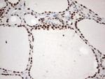 MLF1 Antibody in Immunohistochemistry (Paraffin) (IHC (P))