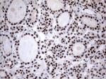 MLF1 Antibody in Immunohistochemistry (Paraffin) (IHC (P))