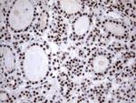 MLF1 Antibody in Immunohistochemistry (Paraffin) (IHC (P))
