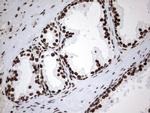 MLF1 Antibody in Immunohistochemistry (Paraffin) (IHC (P))