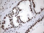 MLF1 Antibody in Immunohistochemistry (Paraffin) (IHC (P))