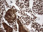 MLF1 Antibody in Immunohistochemistry (Paraffin) (IHC (P))
