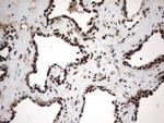 MLF1 Antibody in Immunohistochemistry (Paraffin) (IHC (P))