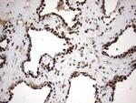 MLF1 Antibody in Immunohistochemistry (Paraffin) (IHC (P))