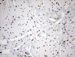 MLF1 Antibody in Immunohistochemistry (Paraffin) (IHC (P))