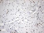 MLF1 Antibody in Immunohistochemistry (Paraffin) (IHC (P))