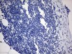 MLF1 Antibody in Immunohistochemistry (Paraffin) (IHC (P))