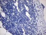 MLF1 Antibody in Immunohistochemistry (Paraffin) (IHC (P))