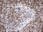 MLF1 Antibody in Immunohistochemistry (Paraffin) (IHC (P))