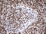 MLF1 Antibody in Immunohistochemistry (Paraffin) (IHC (P))