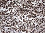 MLF1 Antibody in Immunohistochemistry (Paraffin) (IHC (P))