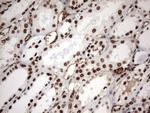 MLF1 Antibody in Immunohistochemistry (Paraffin) (IHC (P))