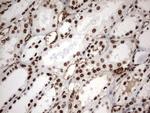 MLF1 Antibody in Immunohistochemistry (Paraffin) (IHC (P))