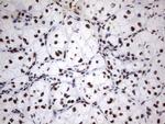 MLF1 Antibody in Immunohistochemistry (Paraffin) (IHC (P))