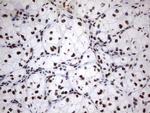 MLF1 Antibody in Immunohistochemistry (Paraffin) (IHC (P))