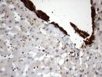 MLF1 Antibody in Immunohistochemistry (Paraffin) (IHC (P))