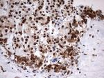 MLF1 Antibody in Immunohistochemistry (Paraffin) (IHC (P))