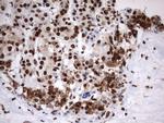 MLF1 Antibody in Immunohistochemistry (Paraffin) (IHC (P))