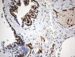 MLF1 Antibody in Immunohistochemistry (Paraffin) (IHC (P))