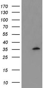 MLF1 Antibody in Western Blot (WB)