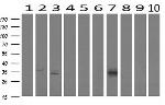 MLF1 Antibody in Western Blot (WB)