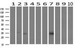 MLF1 Antibody in Western Blot (WB)