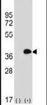 MLF1 Antibody in Western Blot (WB)