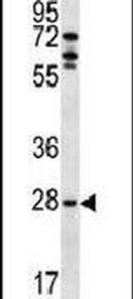 MLF1 Antibody in Western Blot (WB)