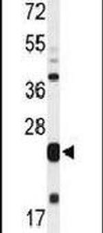 MLF1 Antibody in Western Blot (WB)