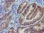 MLF2 Antibody in Immunohistochemistry (Paraffin) (IHC (P))