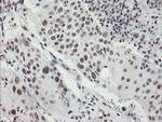 MLF2 Antibody in Immunohistochemistry (Paraffin) (IHC (P))