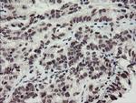 MLF2 Antibody in Immunohistochemistry (Paraffin) (IHC (P))