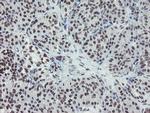 MLF2 Antibody in Immunohistochemistry (Paraffin) (IHC (P))