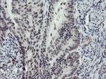 MLF2 Antibody in Immunohistochemistry (Paraffin) (IHC (P))