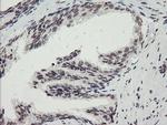 MLF2 Antibody in Immunohistochemistry (Paraffin) (IHC (P))